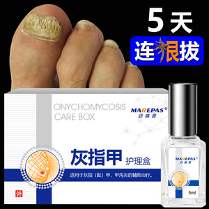 迈瑞普 灰指甲专用液